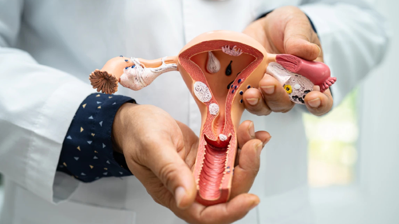 her 10 kadindan 1i risk altinda polikistik over sendromu belirtilerine dikkat MZwRGjY4